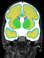 Xu.17.icip-coronal30Test517Seg.png