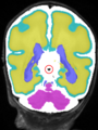 Xu.17.icip-coronal30Test529Seg circles.png