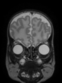 Xu.17.icip-coronal40Test5021Input.png