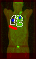 Carlinet.15.tip-petct.png